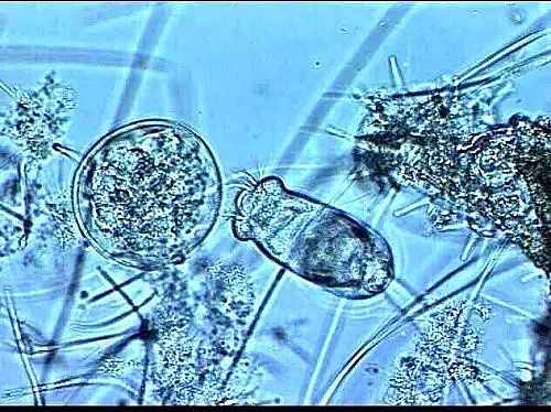 陽離子聚丙烯酰胺CPAM生產(chǎn)廠家—引起污泥膨脹的這些原因