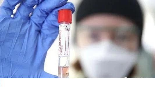 ú�|�w������̿0.5-1mm�S�ҰĴ������о��ˆT�_�l���z�y��ˮ��Covid-19�����ϵ�y