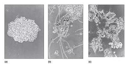 環保粉狀活性炭廠家污水廠應對污泥膨脹的技術管理