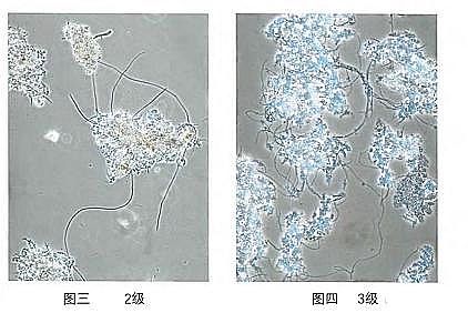 環保粉狀活性炭廠家污水廠應對污泥膨脹的技術管理