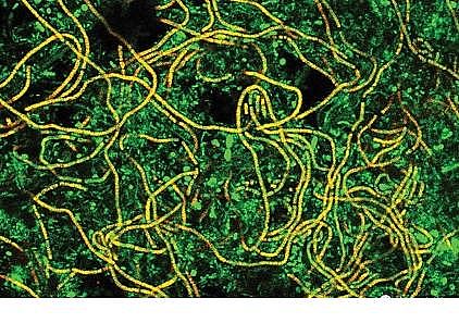 上等陰離子聚丙烯酰胺HPAM生產廠家從污水廠冬季運行氨氮的問題深入探討污水廠的實驗性課題研究